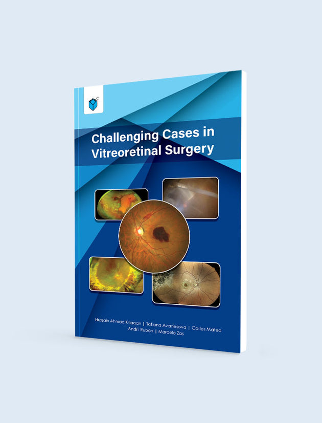CHALLENGING CASES IN VITREORETINAL SURGERY